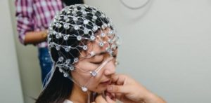 electroencephalogram EEG